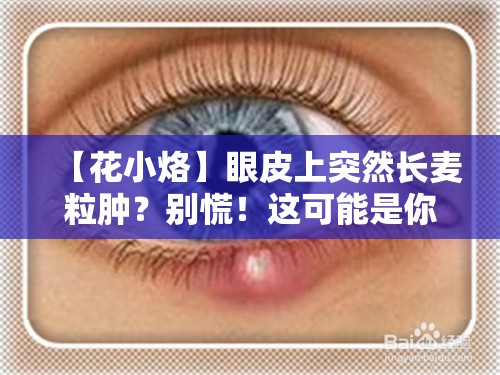 【花小烙】眼皮上为什么会突然长麦粒肿？